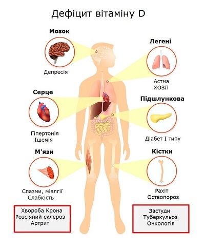 Небезпеки дефіциту вітаміну Д3